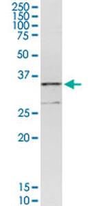 CENPH Antibody in Western Blot (WB)