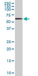 ACD Antibody in Western Blot (WB)