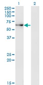 ACD Antibody in Western Blot (WB)