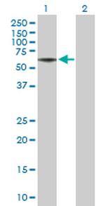 RTN4R Antibody in Western Blot (WB)