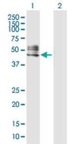 RTN4R Antibody in Western Blot (WB)