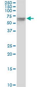 VPS33A Antibody in Western Blot (WB)