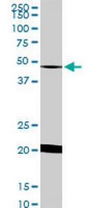 NADK Antibody in Western Blot (WB)