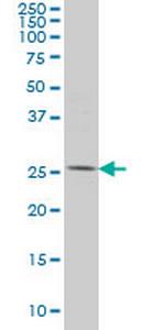 PYCRL Antibody in Western Blot (WB)