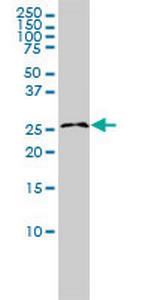 RASL11B Antibody in Western Blot (WB)