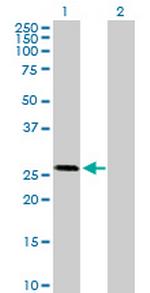 OTUB2 Antibody in Western Blot (WB)