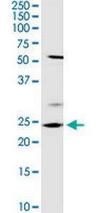 OTUB2 Antibody in Western Blot (WB)