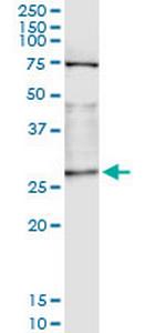 OTUB2 Antibody in Immunoprecipitation (IP)