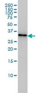 PDCL3 Antibody in Western Blot (WB)