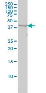 WDR77 Antibody in Western Blot (WB)