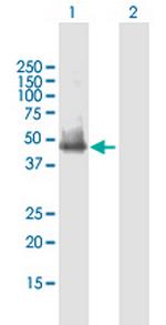 SLC25A23 Antibody in Western Blot (WB)