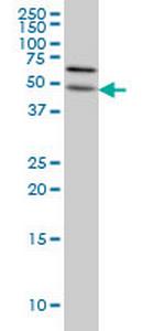 ALG12 Antibody in Western Blot (WB)