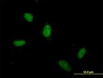 ZSCAN5A Antibody in Immunocytochemistry (ICC/IF)