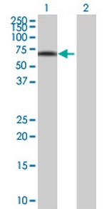 IRX3 Antibody in Western Blot (WB)