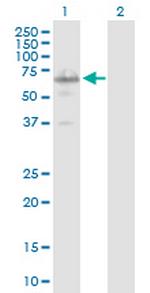 IRX3 Antibody in Western Blot (WB)