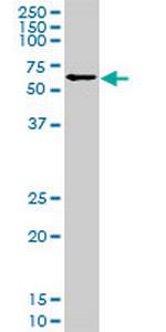 IRX3 Antibody in Western Blot (WB)