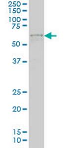 IRX3 Antibody in Western Blot (WB)