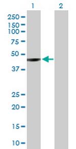 NEIL1 Antibody in Western Blot (WB)