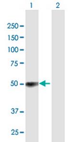 ZCCHC6 Antibody in Western Blot (WB)