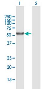 UGT2A3 Antibody in Western Blot (WB)