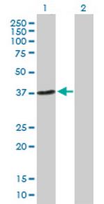 NHEJ1 Antibody in Western Blot (WB)