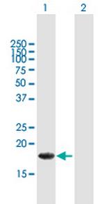 ALG13 Antibody in Western Blot (WB)