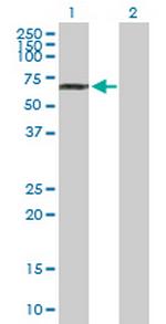 NUP85 Antibody in Western Blot (WB)