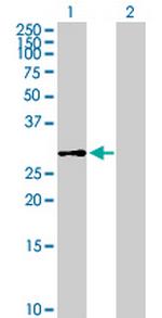 DHDDS Antibody in Western Blot (WB)