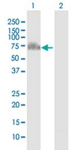 GRHL2 Antibody in Western Blot (WB)