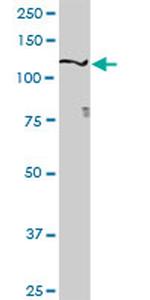 SEMA6D Antibody in Western Blot (WB)