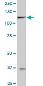 SEMA6D Antibody in Western Blot (WB)