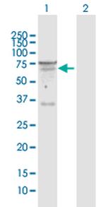 SEMA6D Antibody in Western Blot (WB)