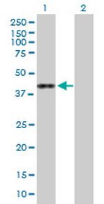 ASRGL1 Antibody in Western Blot (WB)