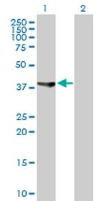 ASRGL1 Antibody in Western Blot (WB)