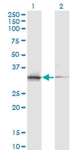 ASRGL1 Antibody in Western Blot (WB)