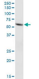 FLJ20920 Antibody in Western Blot (WB)