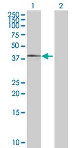 MTERFD3 Antibody in Western Blot (WB)