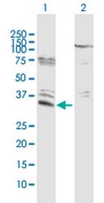 EFHD1 Antibody in Western Blot (WB)