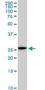 EFHD1 Antibody in Western Blot (WB)