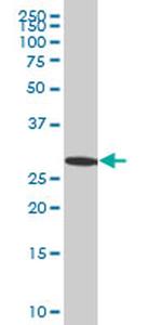 EFHD1 Antibody in Western Blot (WB)