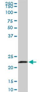 EFHD1 Antibody in Western Blot (WB)