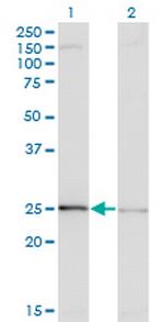 EFHD1 Antibody in Western Blot (WB)