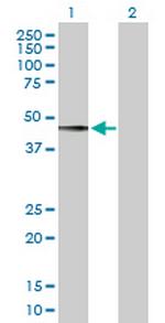 PDGFD Antibody in Western Blot (WB)