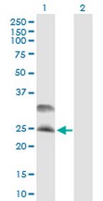 DNAJC5 Antibody in Western Blot (WB)