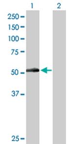 PNPLA3 Antibody in Western Blot (WB)