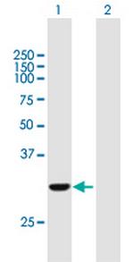 COASY Antibody in Western Blot (WB)