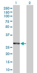 COASY Antibody in Western Blot (WB)