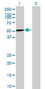 GRINL1A Antibody in Western Blot (WB)