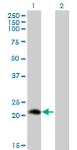 PLA2G12A Antibody in Western Blot (WB)