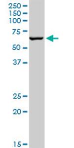 TRIM8 Antibody in Western Blot (WB)